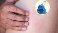 Obniża ryzyko zawału i udaru. Wystarczy zastrzyk