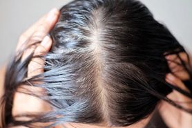 7 błędów w zimowej pielęgnacji włosów