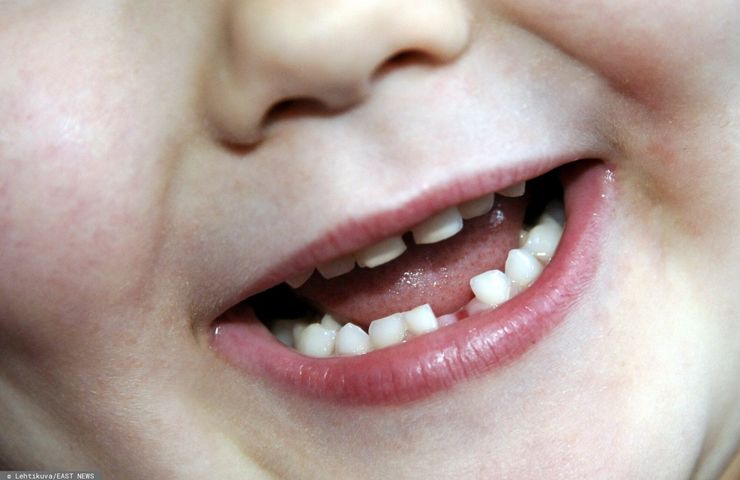 Zęby mleczne można przechowywać w bankach komórek macierzystych