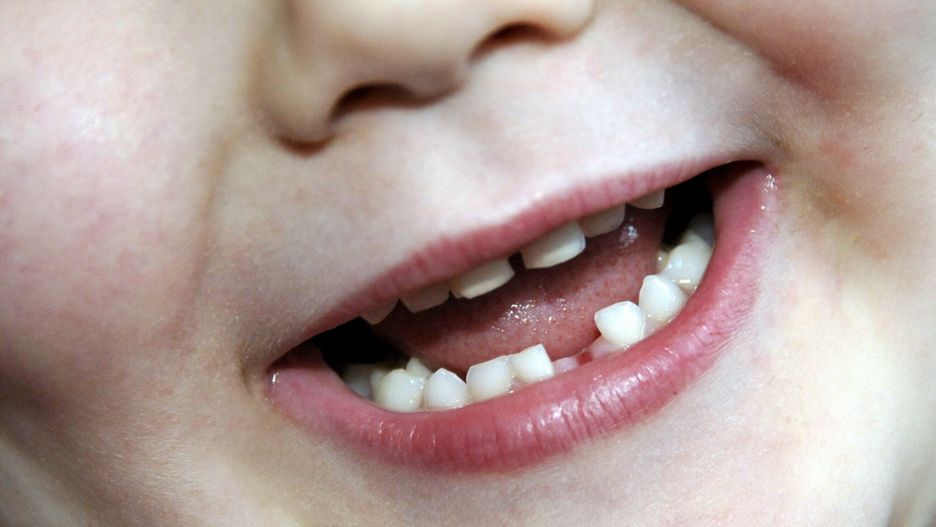 Zęby mleczne można przechowywać w bankach komórek macierzystych