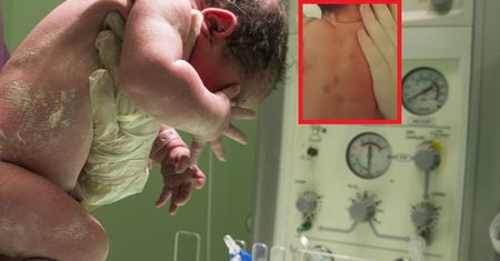 Położna zauważyła fioletowe kropki. To był jedyny objaw groźnej choroby