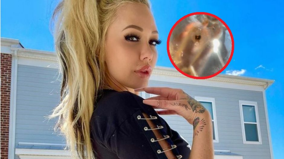 Tak wyglądają implanty piersi po usunięciu