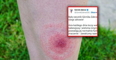 Górnik Zabrze zachęca do wsparcia zbiórki. Ostra krytyka lekarzy