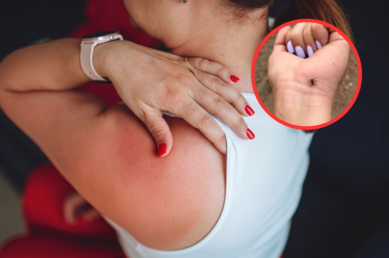 Atakują chmarami. "Wchodzą we włosy, pod ubranie"