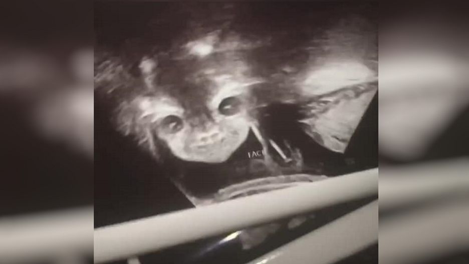 "Diabelskie dziecko" ze zdjęcia USG to pogodna na co dzień Autumn