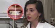 Zęby ciągle są żółte? Dentystka mówi o powszechnym błędzie
