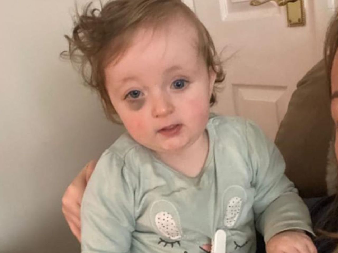 Lekarz odesłał do domu dziecko z siniakiem. Zignorował groźną chorobę