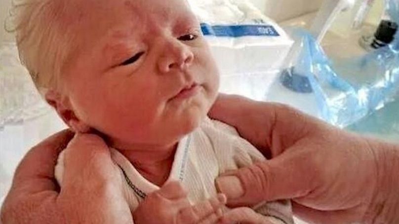 Kiedy się urodził lekarze byli w szoku. Jego włosy były śnieżnobiałe