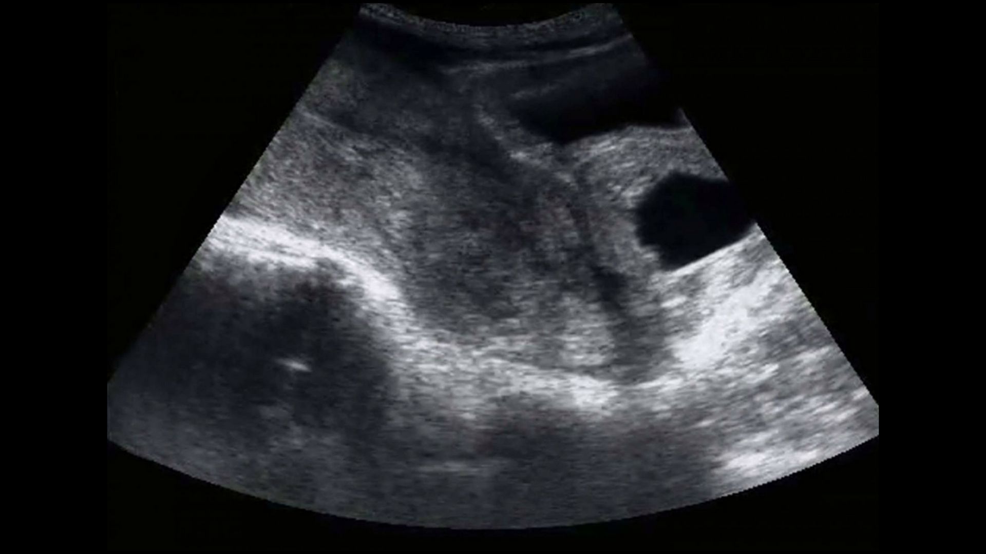 Zdjęcie USG Emily, pod którym opublikowała list