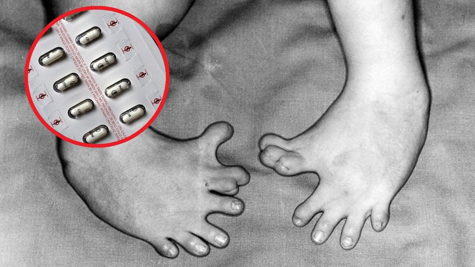 To dlatego rodziły się zdeformowane dzieci