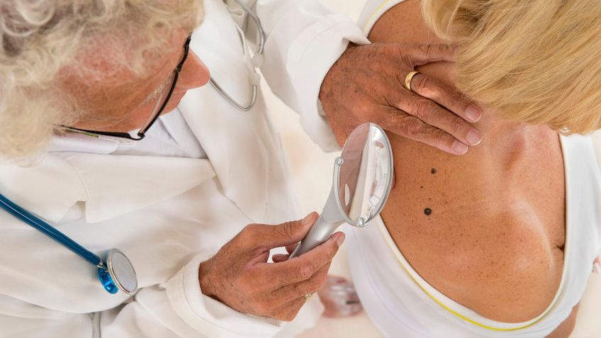 Jak wygląda badanie skóry?