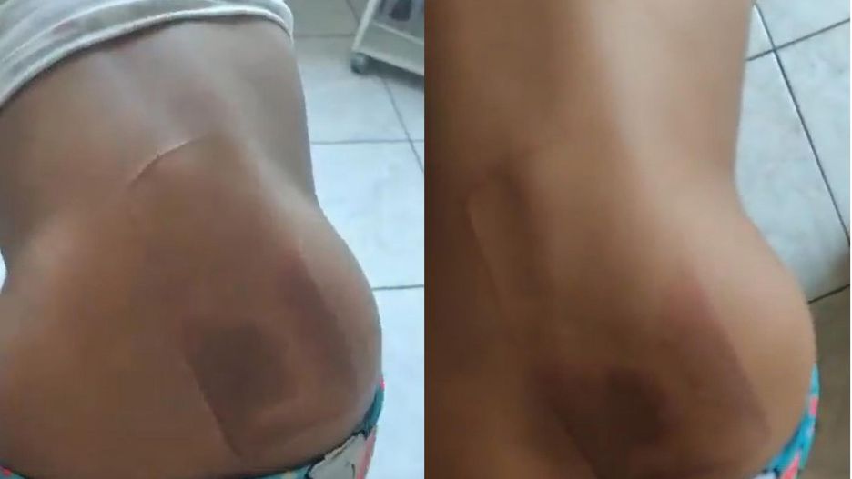 telefon poparzył jej plecy