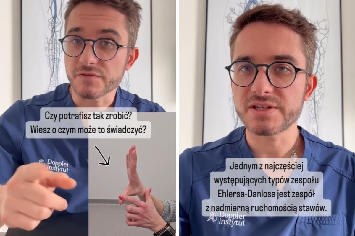 Gibkość ciała może zdradzać zespół Ehlersa-Danlosa