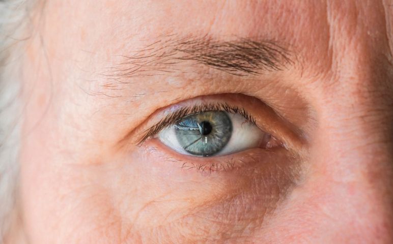 Zaburzenia widzenia na tle nerwowym pojawiają się w różnych okolicznościach i manifestują się na wiele sposobów.