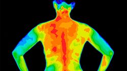 Termografia - wskazania, przebieg, bezpieczeństwo, zastosowanie
