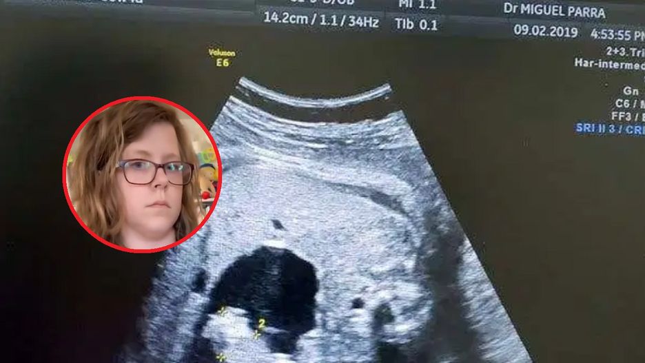 Urodziła dwie pary bliźniąt i ponownie zaszła w ciążę