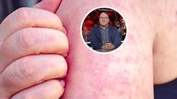 W Polsce liczba chorych wzrosła o 700 proc. "Jedna osoba zaraża 18"