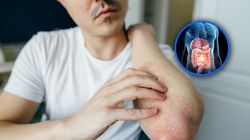 Sygnalizuje choroby jelit, trzustki. Objawy widać na skórze