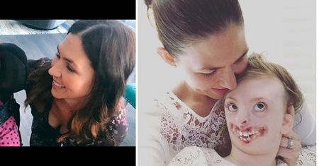 Zdjęcie Sophie Weaver wykorzystano, aby promować aborcję. Dziewczynka chora na zespół Retta nie żyje