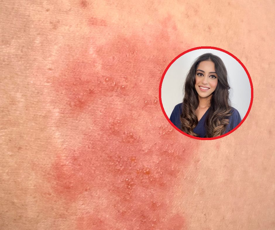 Dermatolożka ostrzega. Ten nawyk może skończyć się infekcją mózgu