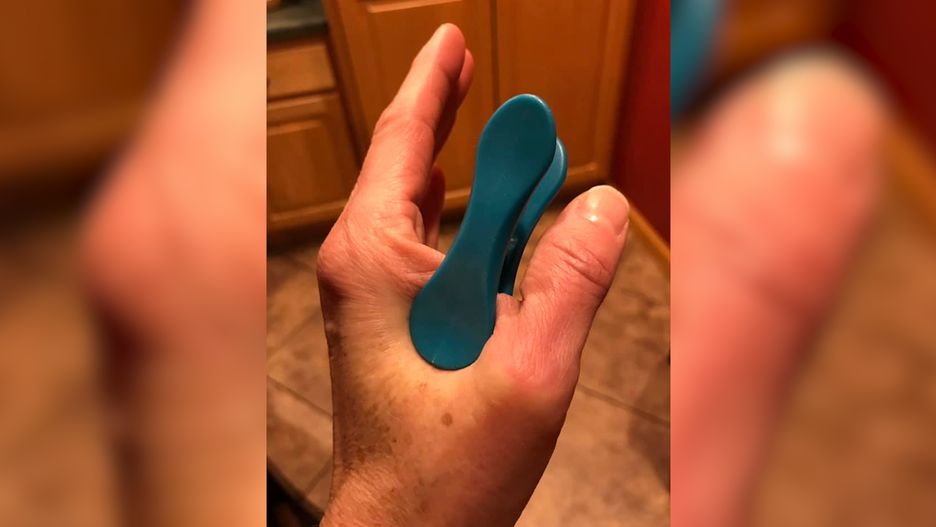 Klips wpięty w dłoń wyleczył kobietę z migreny