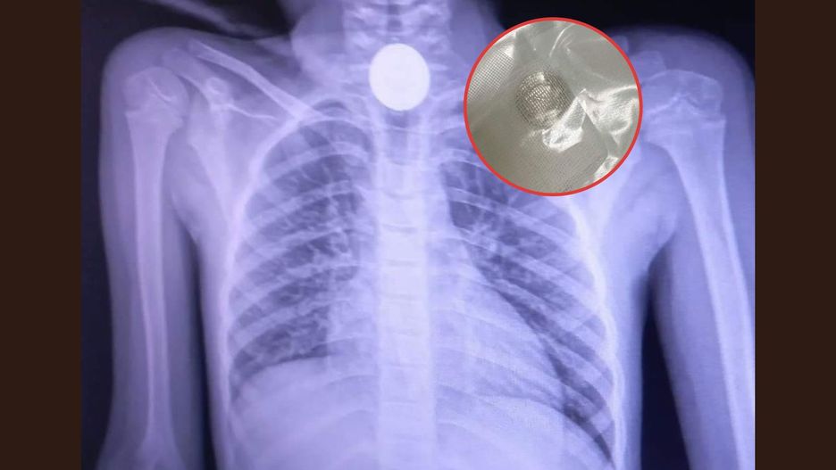 "Dzieci potrafią zaskakiwać". Szpital opublikował zdjęcie