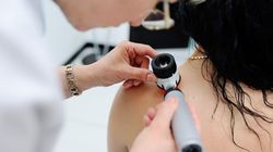 Dermatolog - kim jest i czym się zajmuje? Jak wygląda badanie?