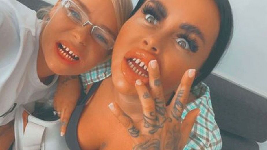 Skuszone niską ceną zdecydowały się na licówki. Tureckie zęby zrujnowały im zdrowie i życie