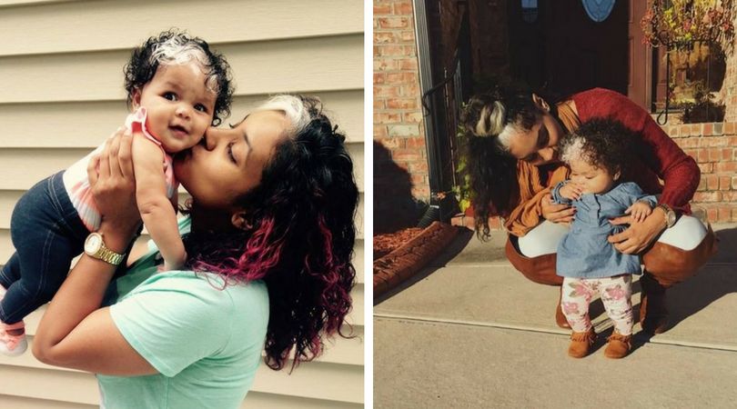 Przyczyną białego pasma włosów jest zaburzenie genetyczne