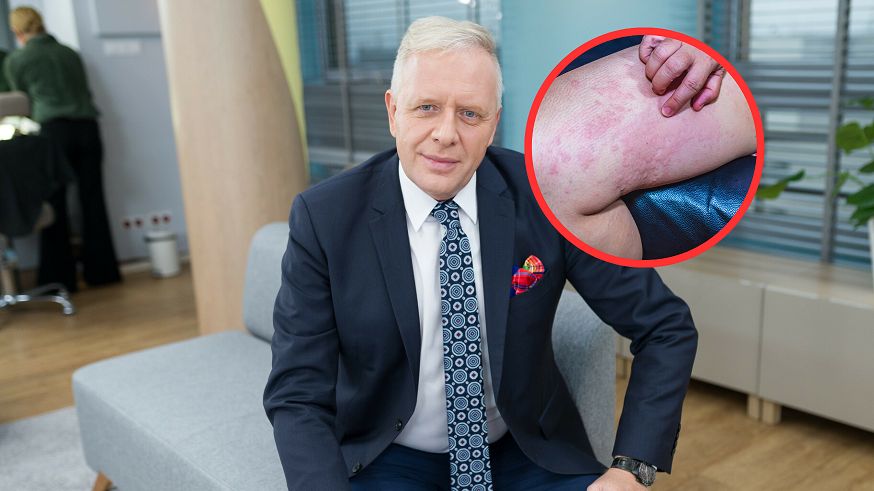 Szczepienia zapobiegają 5 mln zgonów rocznie, ale to się może zmienić. Dr Sutkowski ostrzega