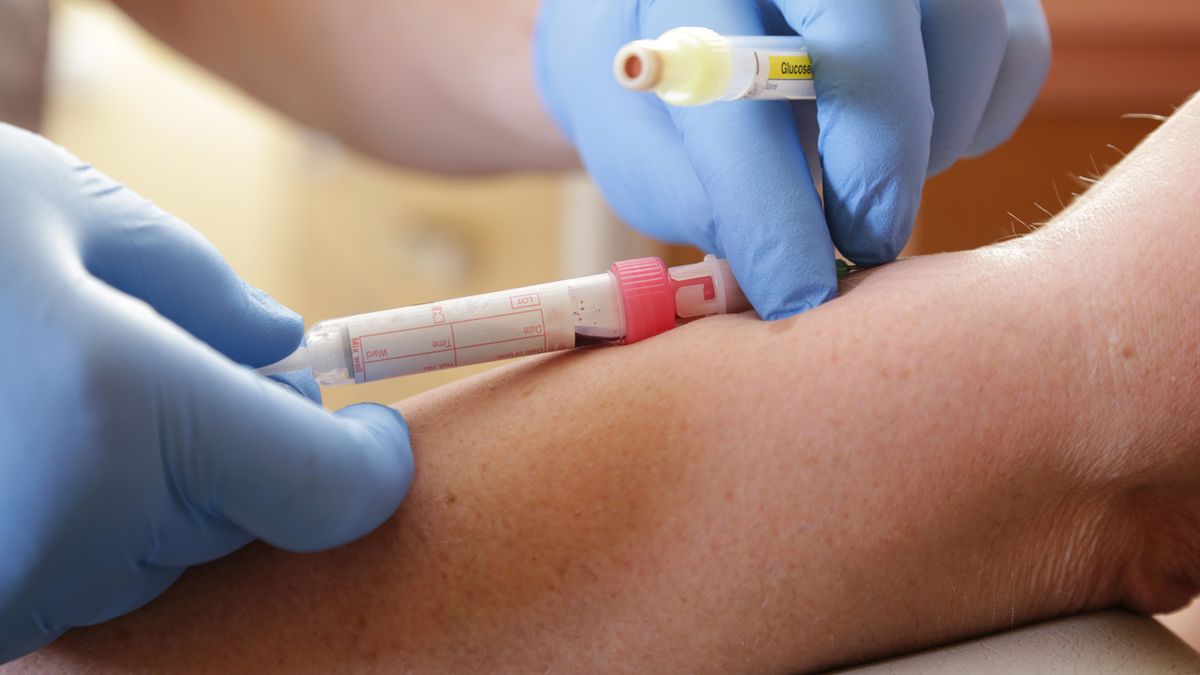 Krzywa insulinowa stosowana jest w diagnostyce insulinooporności i cukrzycy.