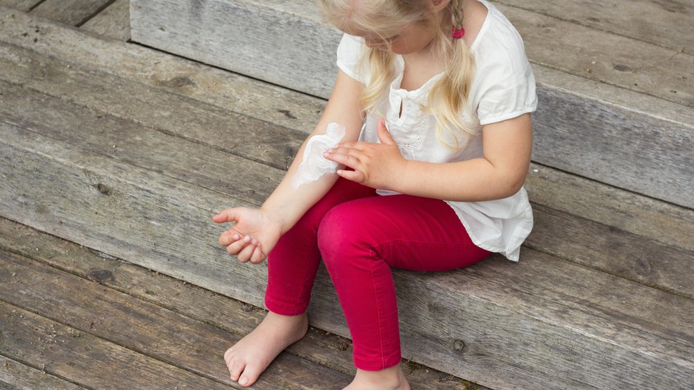 Typowym objawem mięczaka zakaźnego są białe lub perłowe guzki