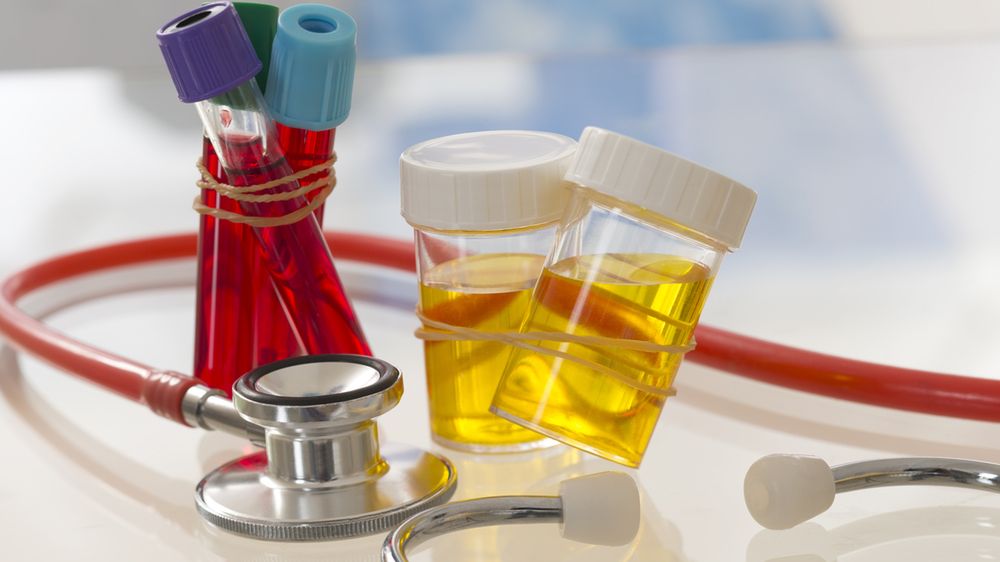 Badania, dzięki którym zapomnisz o nawracającym zakażeniu dolnych dróg moczowych