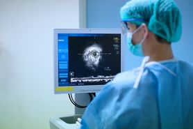Ultrasonografia wewnątrznaczyniowa – charakterystyka, wskazania i przebieg badania
