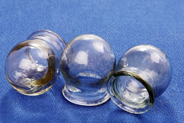 Szklane bańki do stawiania na gorąco