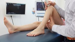 Odbudowa kości - na czym polega i ile trwa?