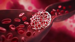 Niski poziom hemoglobiny - przyczyny, leczenie