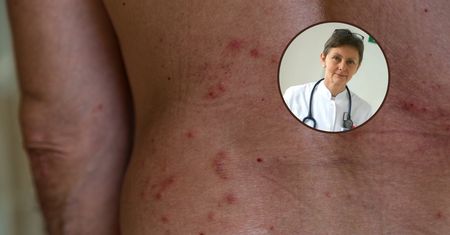 Zachoruje co trzeci po 50-tce. "Objawy są bardzo dotkliwe"