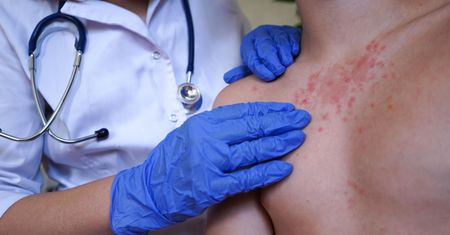 Eksperci alarmują przed powrotem epidemii. Polacy lekceważą profilaktykę
