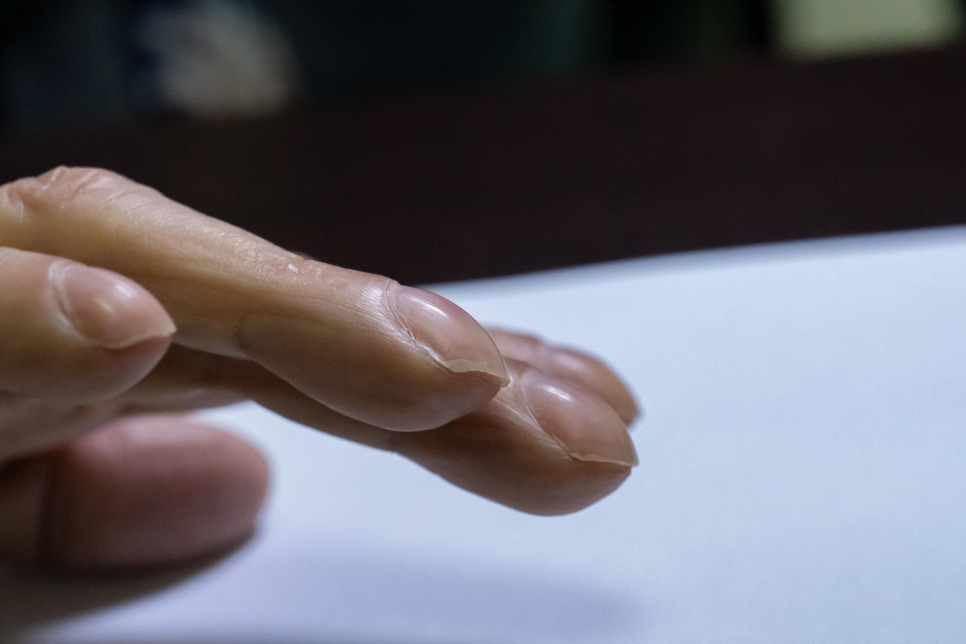 O raku płuc może świadczyć wygląd paznokci