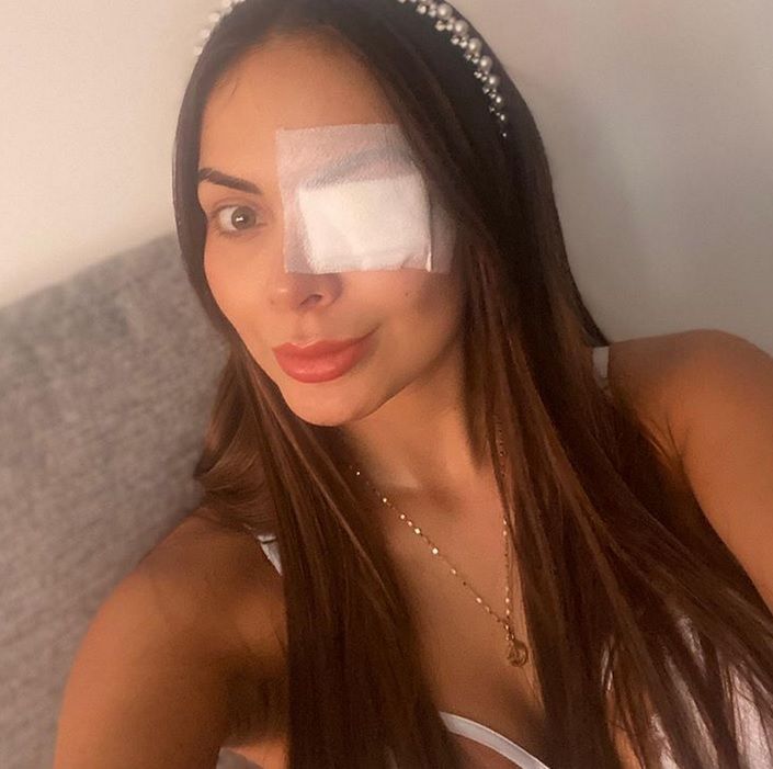 Krem doprowadził do silnej rekacji alergicznej