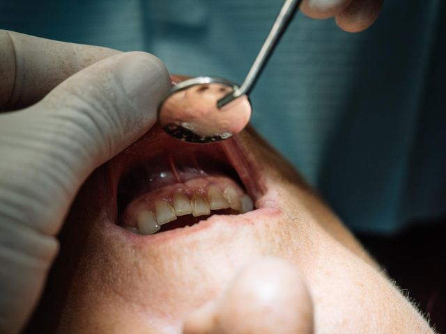 Dentysta rozpozna groźną chorobę. Objawy cukrzycy widoczne w jamie ustnej