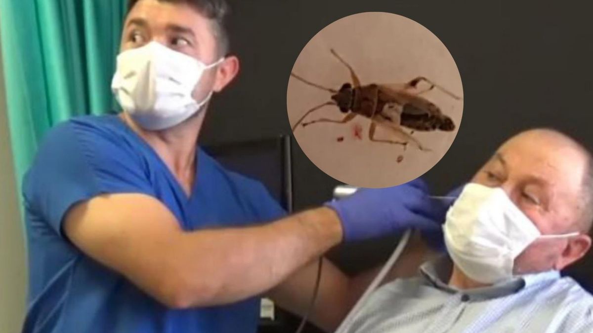 Recep Korkmaz i dr Muhammet Yeniay podczas wyciągania muchy