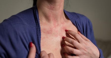 Cierpi co piąty Polak. Problem zwiększa ryzyko raka piersi i tarczycy