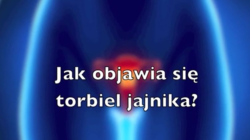 Warto znać objawy torbieli jajnika 