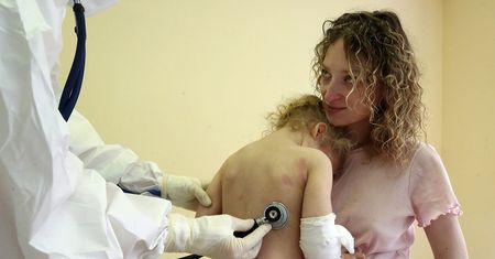 Syndrom PIMS-TS jako powikłanie po COVID-19 u dzieci. Przypomina chorobę Kawasakiego