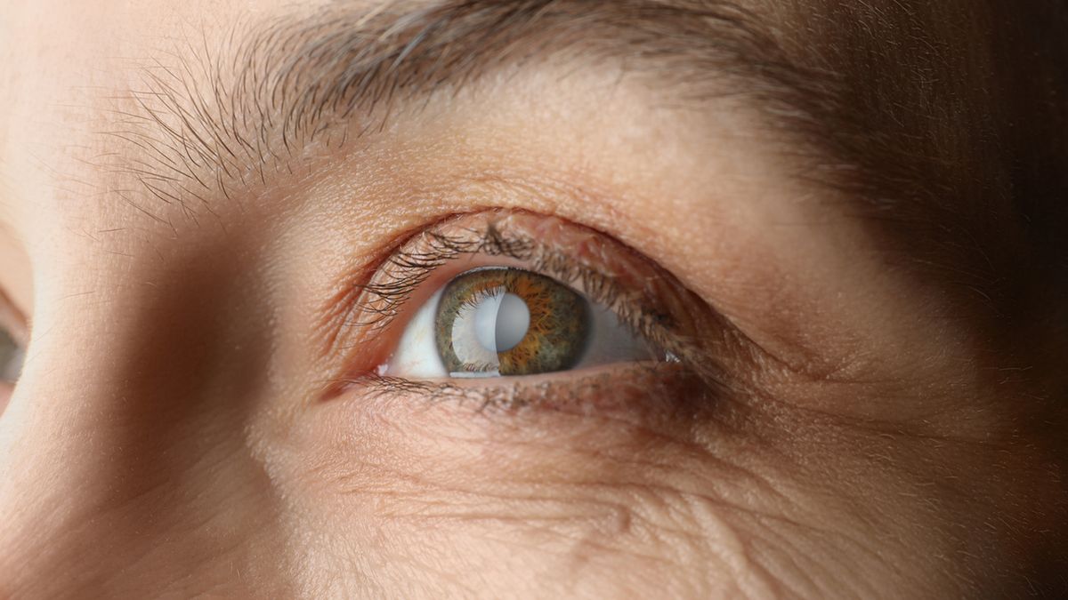 Odklejenie siatkówki - objawy, przyczyny, leczenie