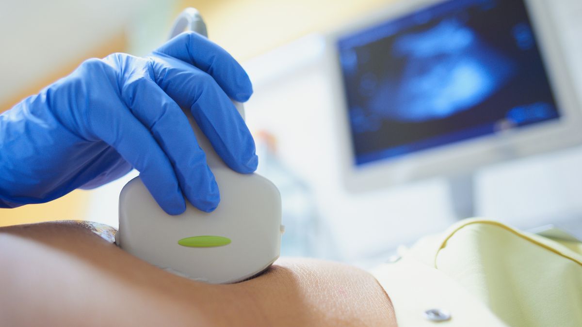 Kłębuszkowe zapalenie nerek to choroba układu moczowego i nerek, która może prowadzić do poważnych powikłań zdrowotnych.