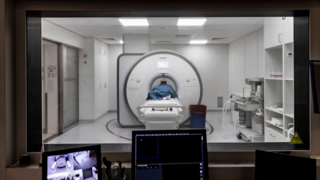 Nawet po łagodnym zakażeniu koronawirusem mogą się utrzymywać długoterminowe uszkodzenia neurologiczne