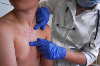 Grzyby mogą prowadzić do ciężkich zakażeń. "Rozwijają się po cichu, w cieniu innych chorób"